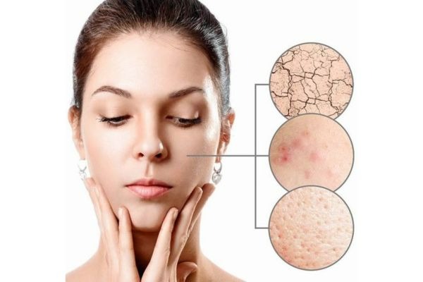 Các loại sản phẩm dành cho da khô trong thứ tự trang điểm