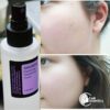 Nước hoa hồng COSRX AHA/BHA Clarifying Treatment