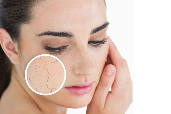 Cách nhận biết da khô