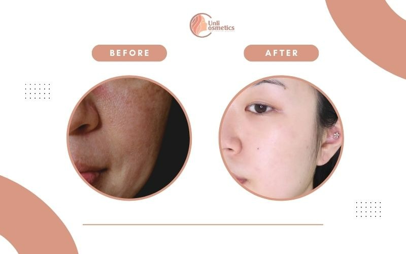 TONER SÁNG DA INNISFREE JEJU CHERRY BLOSSOM SKIN