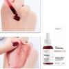 Serum tẩy tế bào chết, cải thiện mụn The Ordinary AHA 30% BHA 2% Peeling Solution