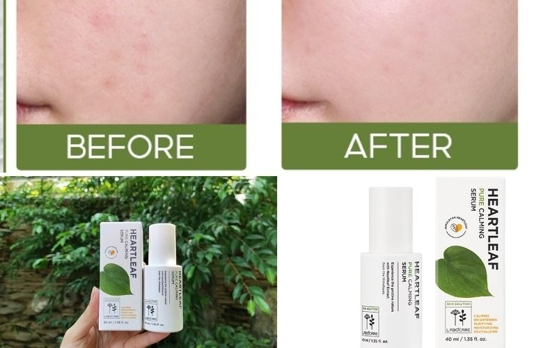 Tinh Chất Làm Dịu Da Chiết Xuất Diếp Cá Labocare tinh chất Heartleaf Pure Calming Serum 40ml