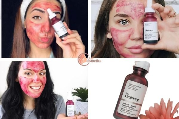 Tinh Chất The Ordinary AHA 30% BHA 2% Peeling Solution