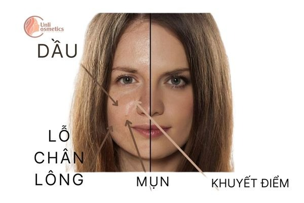 những bất lợi da dầu mang lại