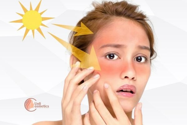 Tác động của môi trường đến da nhạy cảm