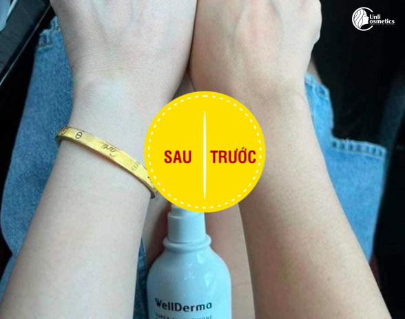 Dưỡng Trắng Body Wellderma 