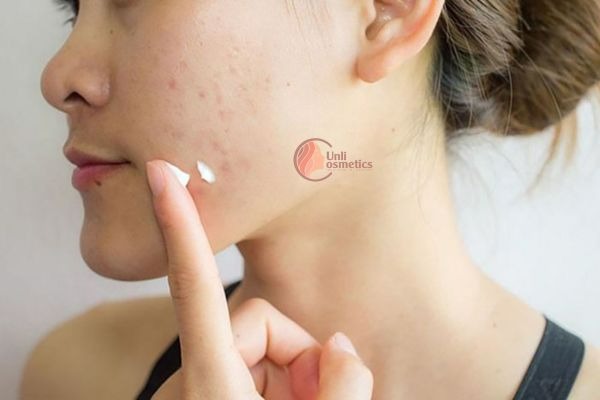 Bôi kem dưỡng cho Da nhạy cảm